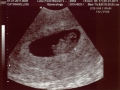 Aiden8w4d01.jpg